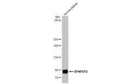 Anti-XPNPEP2 antibody [N3C3] used in Western Blot (WB). GTX109995