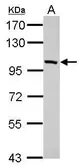 Anti-PDE11A antibody used in Western Blot (WB). GTX110015