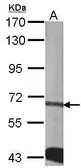 Anti-CDKAL1 antibody used in Western Blot (WB). GTX110020