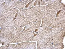 Anti-MCD antibody [N2C1], Internal used in IHC (Paraffin sections) (IHC-P). GTX110037