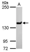 Anti-JARID1C antibody [N1N2-2], N-term used in Western Blot (WB). GTX110045
