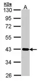 Anti-CRTAP antibody [N2C3-2] used in Western Blot (WB). GTX110055