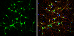 Anti-NF-H antibody used in Immunocytochemistry/ Immunofluorescence (ICC/IF). GTX110065