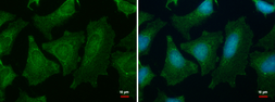Anti-PGM1 antibody used in Immunocytochemistry/ Immunofluorescence (ICC/IF). GTX110069