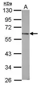Anti-Vitamin D Binding Protein antibody used in Western Blot (WB). GTX110073