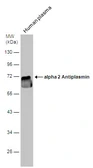 Anti-Alpha 2 Antiplasmin antibody [N3C3] used in Western Blot (WB). GTX110076