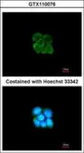 Anti-Alpha 2 Antiplasmin antibody [N3C3] used in Immunocytochemistry/ Immunofluorescence (ICC/IF). GTX110076