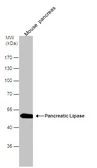 Anti-Pancreatic Lipase antibody [N3C3] used in Western Blot (WB). GTX110086