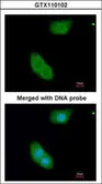 Anti-EHBP1 antibody [N3C2], Internal used in Immunocytochemistry/ Immunofluorescence (ICC/IF). GTX110102