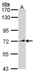 Anti-VANGL1 antibody [N1C1] used in Western Blot (WB). GTX110123