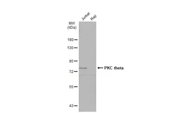 Anti-PKC theta antibody [N1N3-2] used in Western Blot (WB). GTX110127