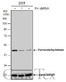 Anti-Fumarate hydratase antibody [N2C2], Internal used in Western Blot (WB). GTX110128