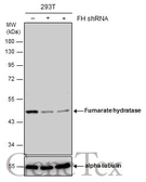 Anti-Fumarate hydratase antibody [N2C2], Internal used in Western Blot (WB). GTX110128