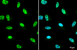 Anti-O-GlcNAc transferase antibody [N1N2], N-term used in Immunocytochemistry/ Immunofluorescence (ICC/IF). GTX110136