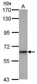 Anti-C9 antibody [N2C2-2], Internal used in Western Blot (WB). GTX110161