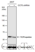 Anti-TCP1 epsilon antibody [N1C1] used in Western Blot (WB). GTX110167