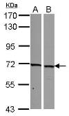 Anti-NCOA62 antibody used in Western Blot (WB). GTX110169