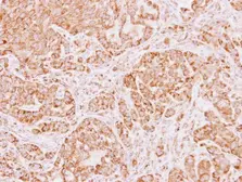 Anti-ALDH5A1 antibody [N1C1] used in IHC (Paraffin sections) (IHC-P). GTX110181