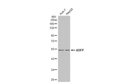 Anti-ADFP antibody [N1C2] used in Western Blot (WB). GTX110204