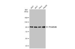Anti-PLA2G4A antibody used in Western Blot (WB). GTX110218