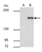 Anti-SETDB1 antibody [N2C1], Internal used in Immunoprecipitation (IP). GTX110219