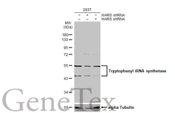 Anti-Tryptophanyl tRNA synthetase antibody used in Western Blot (WB). GTX110223