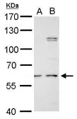 Anti-GALNS antibody used in Western Blot (WB). GTX110237