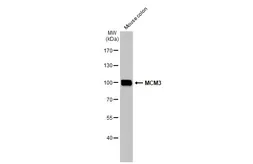 Anti-MCM3 antibody used in Western Blot (WB). GTX110241