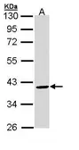 Anti-BMP15 antibody [N3C3] used in Western Blot (WB). GTX110245