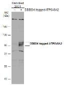 Anti-ATP6V0A2 antibody [N2C1], Internal used in Western Blot (WB). GTX110248