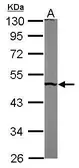 Anti-PUS1 antibody [N2C3] used in Western Blot (WB). GTX110249