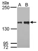 Anti-IKAP antibody [C1C2], Internal used in Western Blot (WB). GTX110274