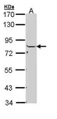 Anti-NSF antibody used in Western Blot (WB). GTX110275