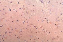 Anti-BACE1 antibody used in IHC (Paraffin sections) (IHC-P). GTX11028