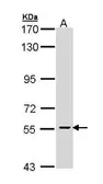Anti-CDC73 antibody [N1C1] used in Western Blot (WB). GTX110280