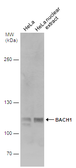 Anti-BACH1 antibody [N2C1], Internal used in Western Blot (WB). GTX110292