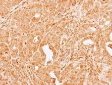 Anti-Factor X antibody used in IHC (Paraffin sections) (IHC-P). GTX110300