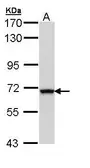 Anti-ALDH4A1 antibody [N3C3] used in Western Blot (WB). GTX110306