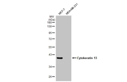 Anti-Cytokeratin 13 antibody used in Western Blot (WB). GTX110308