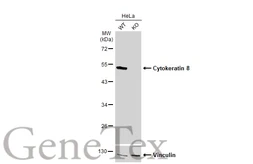 Anti-Cytokeratin 8 antibody used in Western Blot (WB). GTX110311