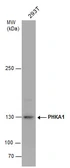 Anti-PHKA1 antibody used in Western Blot (WB). GTX110318