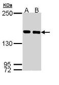 Anti-SMC1A antibody [C1C2], Internal used in Western Blot (WB). GTX110331