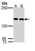 Anti-SMC1A antibody [C1C2], Internal used in Western Blot (WB). GTX110331