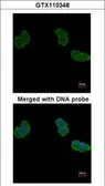 Anti-Aminoacylase 1 antibody [N2C3-2] used in Immunocytochemistry/ Immunofluorescence (ICC/IF). GTX110348