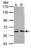 Anti-ARHGEF9 antibody [N2C2-2], Internal used in Western Blot (WB). GTX110357