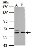 Anti-ARHGEF9 antibody [N2C2-2], Internal used in Western Blot (WB). GTX110357