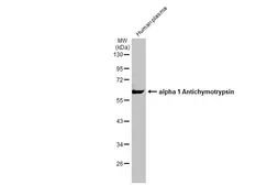 Anti-alpha 1 Antichymotrypsin antibody used in Western Blot (WB). GTX110359