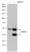 Anti-alpha 1 Antichymotrypsin antibody used in Western Blot (WB). GTX110359