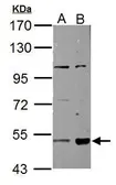 Anti-ALDH3A2 antibody used in Western Blot (WB). GTX110363