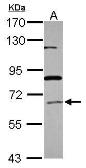 Anti-ACOX1 antibody [N2C2], Internal used in Western Blot (WB). GTX110372